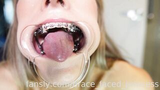 brace_faced_princess: drooly